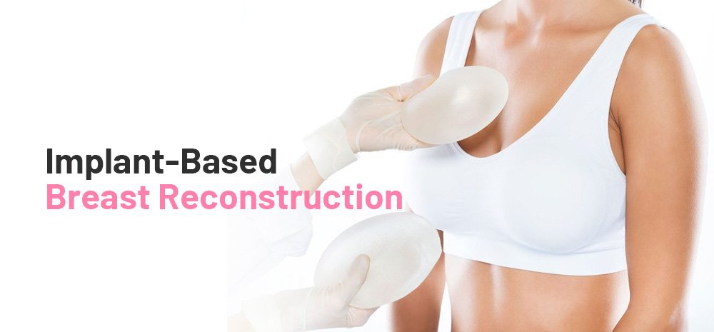 Implant-Based Breast Reconstruction